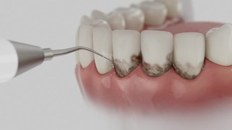Reliable Wisdom Tooth Removal contractor in Taylor County County, GA by Dentist Open Now